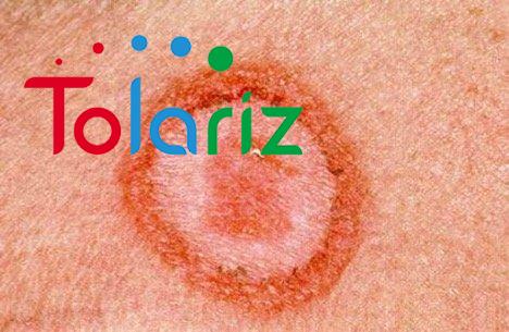 Cách chữa bệnh giang mai tại nhà hiệu quả & an toàn