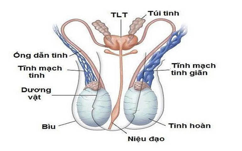 giãn tĩnh mạch thừng tinh