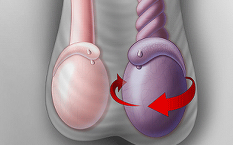 trường hợp khẩn cấp khiến cho người bệnh khá đau đớn và cần được điều trị ngay lập tức
